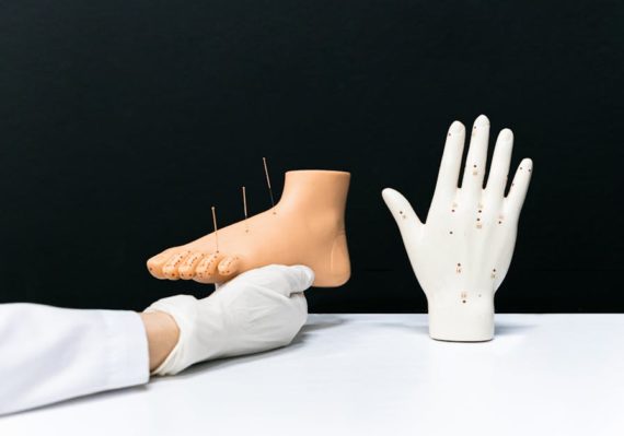 découvrez l'acupression, une méthode thérapeutique ancestrale qui utilise des points de pression sur le corps pour soulager le stress, apaiser les douleurs et favoriser le bien-être général. explorez ses bienfaits et apprenez à l'intégrer dans votre quotidien.